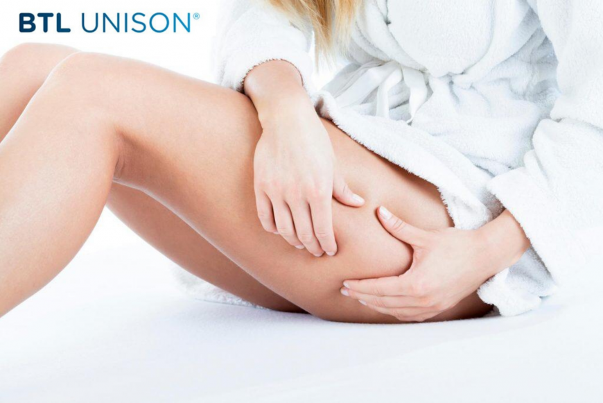 Best cellulite treatment in Dubai Best cellulite treatment in Dubai